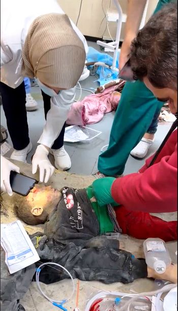 طبيبة تسخدم هاتفها لتوفير إضاءة لفحص طفل في ظل انهيار المستشفيات في غزة
