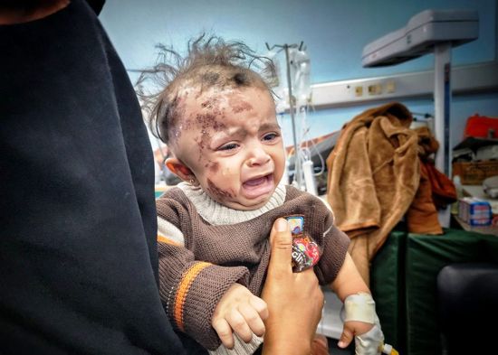 طفل فلسطيني مصاب في قصف اسرائيلي