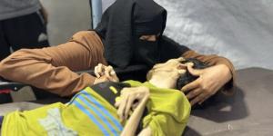 وفاة شاب في غزة بسبب سوء التغذية والتجويع الإسرائيلي المستمر