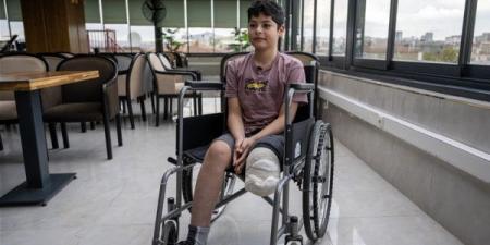 الصحة: 6 آلاف حالة بتر في قطاع غزة