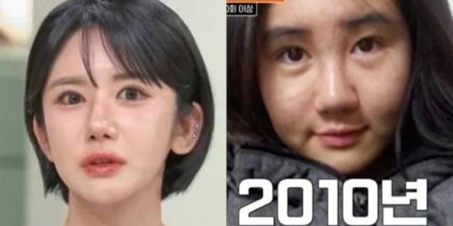 كورية تنفق 210 آلاف دولار على 400 عملية تجميل خلال 15 سنة